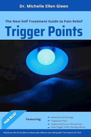 Trigger Points