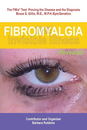 Fibromyalgia