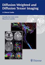 Diffusion Weighted and Diffusion Tensor Imaging