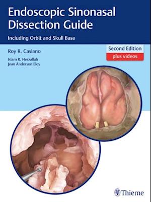 Endoscopic Sinonasal Dissection Guide