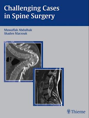 Challenging Cases in Spine Surgery