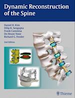 Dynamic Reconstruction of the Spine