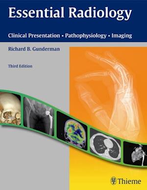 Essential Radiology