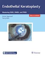 Endothelial Keratoplasty