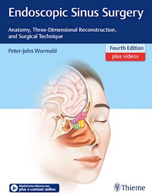 Endoscopic Sinus Surgery