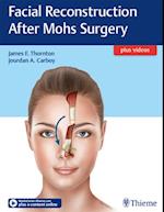 Facial Reconstruction After Mohs Surgery