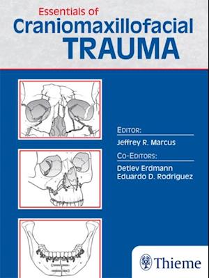 Essentials of Craniomaxillofacial Trauma