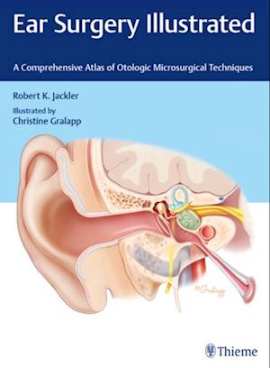 Ear Surgery Illustrated