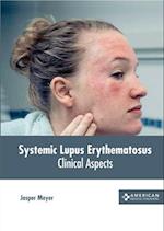 Systemic Lupus Erythematosus: Clinical Aspects 