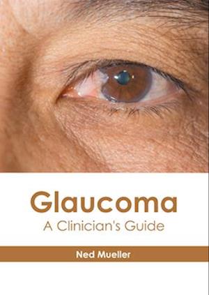 Glaucoma: A Clinician's Guide