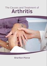 The Causes and Treatment of Arthritis 