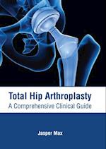 Total Hip Arthroplasty: A Comprehensive Clinical Guide 