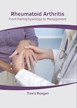 Rheumatoid Arthritis: From Pathophysiology to Management 