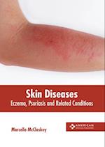 Skin Diseases