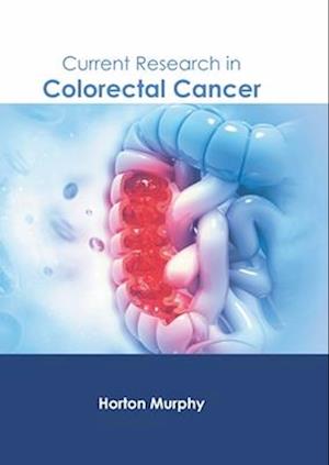 Current Research in Colorectal Cancer