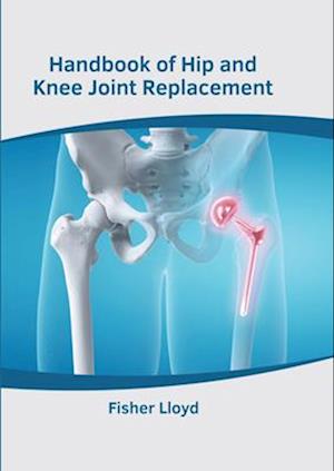 Handbook of Hip and Knee Joint Replacement