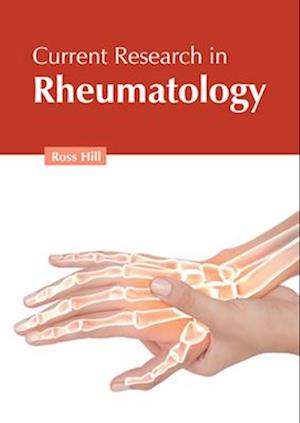 Få Current Research in Rheumatology af som bog på engelsk