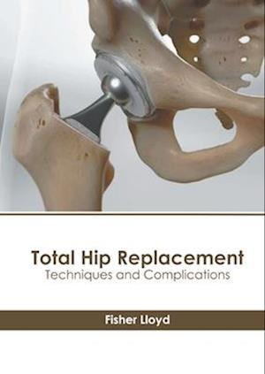 Total Hip Replacement