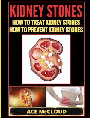 Kidney Stones