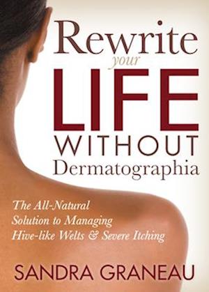 Rewrite Your Life Without Dermatographia