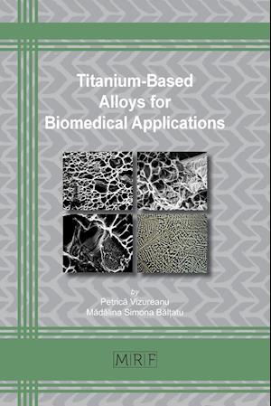 Titanium-Based Alloys for Biomedical Applications
