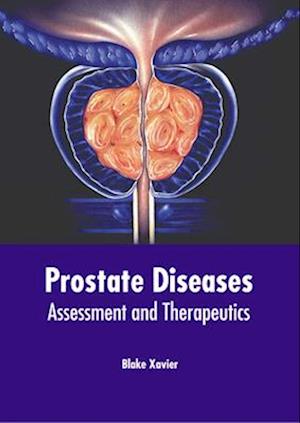 Prostate Diseases