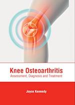 Knee Osteoarthritis: Assessment, Diagnosis and Treatment 