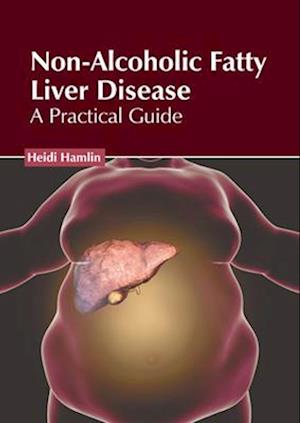 Non-Alcoholic Fatty Liver Disease