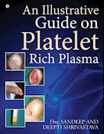 An Illustrative Guide on Platelet Rich Plasma