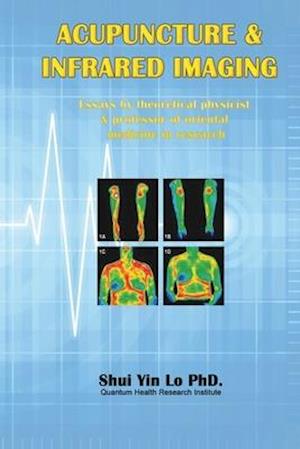 Acupuncture and Infrared Imaging