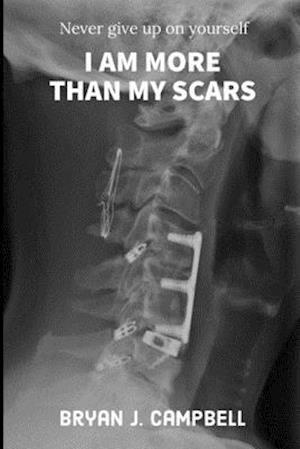 I Am More Than My Scars