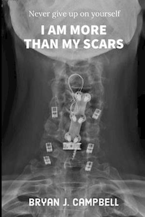 I Am More Than My Scars