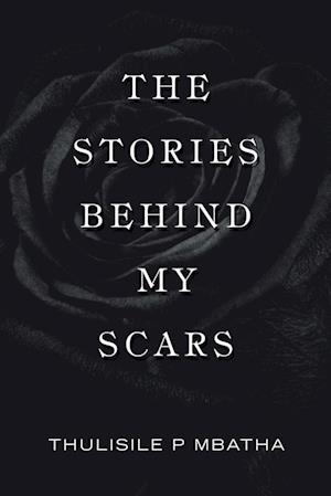 The Stories Behind My Scars