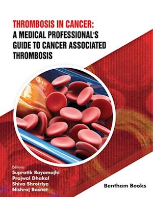 Thrombosis in Cancer: A Medical Professional's Guide to Cancer Associated Thrombosis