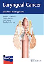 Laryngeal Cancer: Clinical Case-Based Approaches
