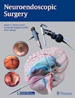 Neuroendoscopic Surgery