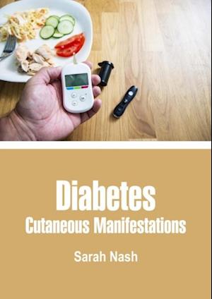 Diabetes