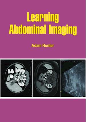 Learning Abdominal Imaging