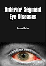 Anterior Segment Eye Diseases