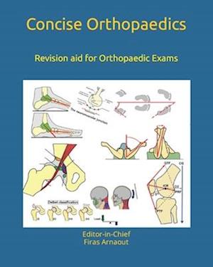 Concise Orthopaedic Notes: Revision aid for FRCS , EBOT , SICOT and Board Examinations