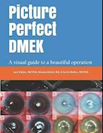 Picture Perfect Dmek