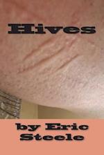 Hives