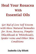 Heal Your Rosacea with Essential Oils