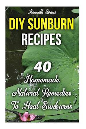 DIY Sunburn Recipes