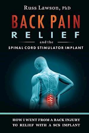 Back Pain Relief and the Spinal Cord Stimulator Implant