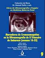 Marcadores Cromosomopatías En La Ultrasonografia de II Trimestre de Embarazo (Semana 18-22)