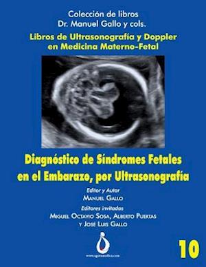 Diagnostico de Síndromes Fetales En El Embarazo, Por Ultrasonografia