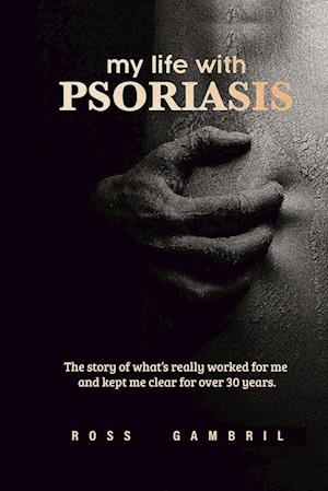 my life with PSORIASIS