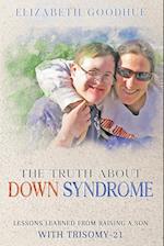 The Truth About Down Syndrome: Lessons Learned from Raising a Son with Trisomy-21: Lessons Learned 