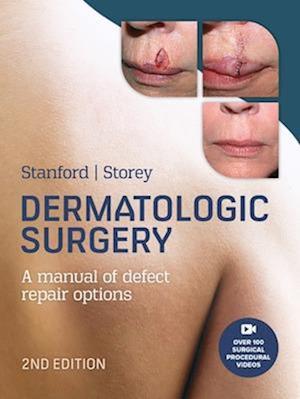 Dermatologic Surgery